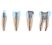  Зображення для категорії Штифти 