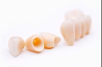  Зображення для категорії Виготовлення тимчасових коронок 